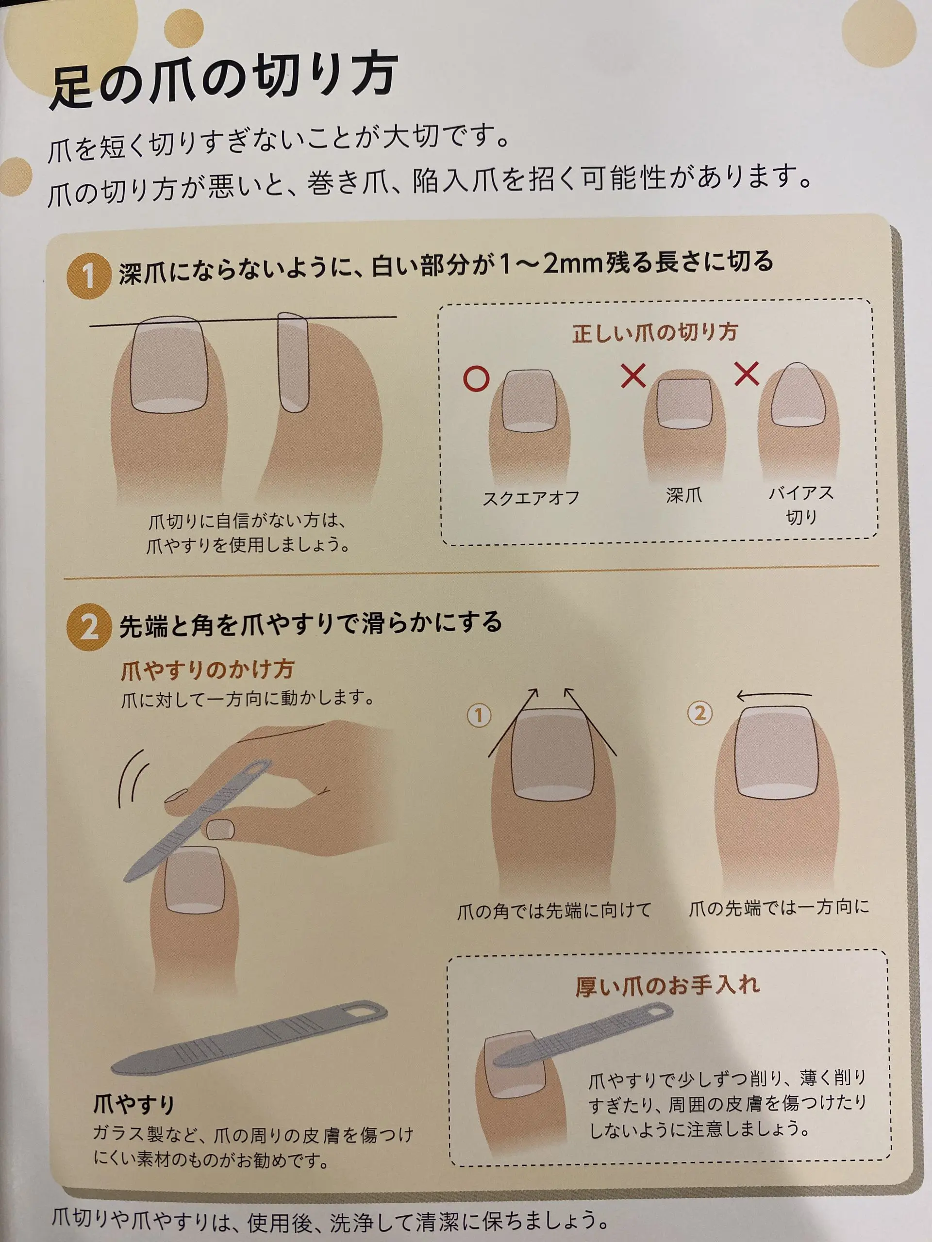 陥入爪 かんにゅうそう について 巣鴨駅前の皮膚科